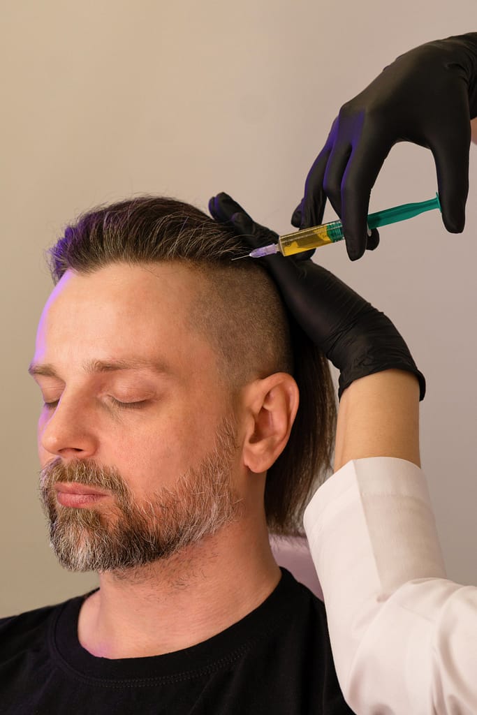 Hair Plasma Rich Platelet